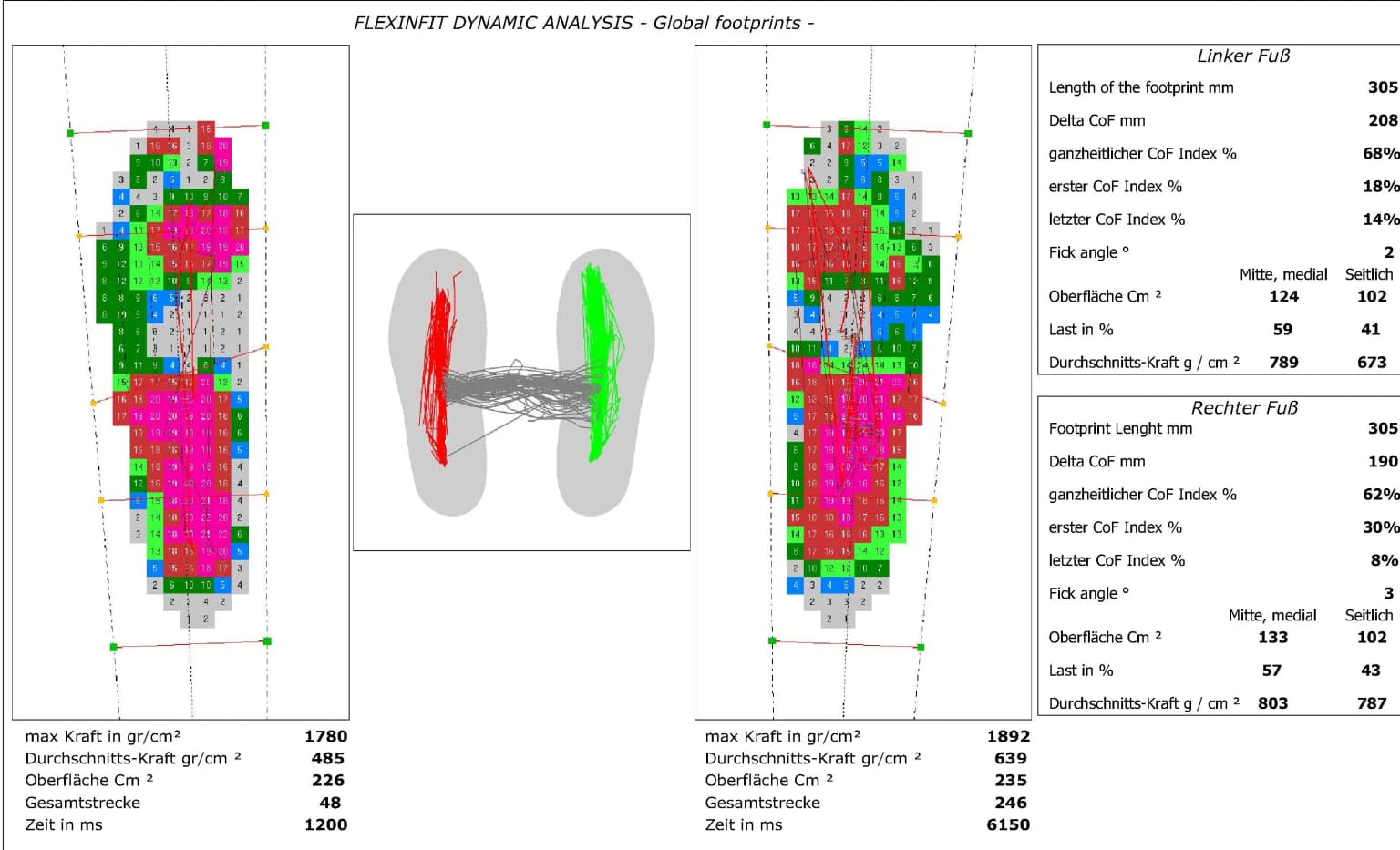 Fußdruckmessung ohne eine diabetesadaptierte Fußbettung - DAF