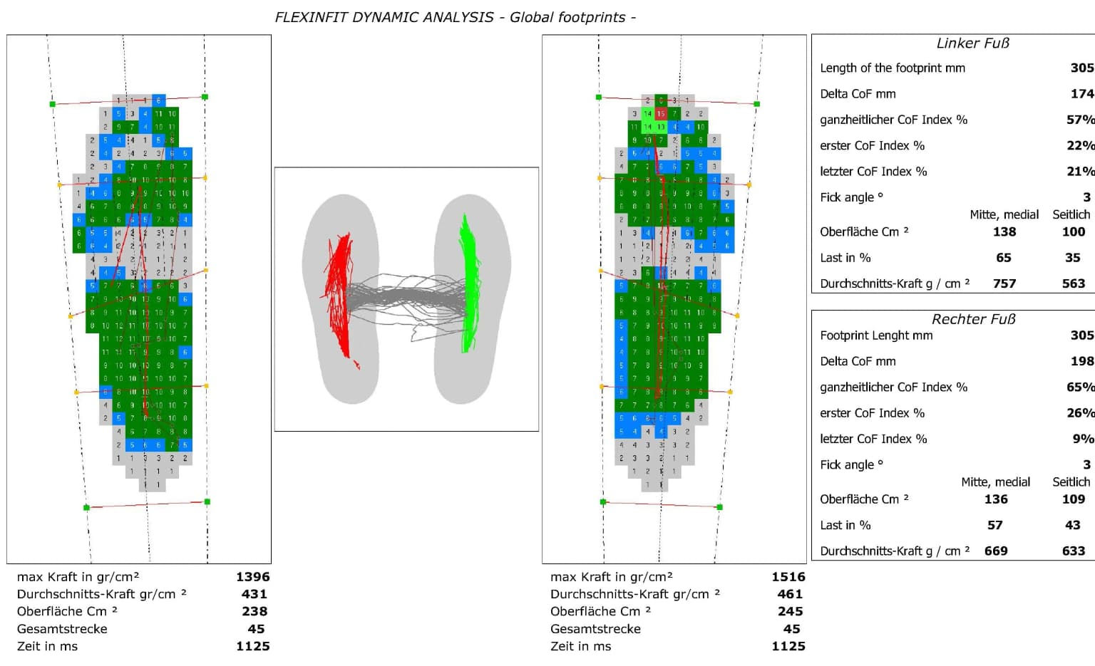 Fußdruckmessung mit einer von uns angefertigten diabetesadaptierten Fußbettung – DAF